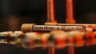 ABD, 2026 Dünya Kupası Öncesi Ebola Tehdidine Karşı Havalimanlarında Önlem Alıyor