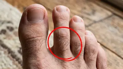 Ayak Kılları Sağlığın Göstergesi mi? Uzmanlar Açıklıyor