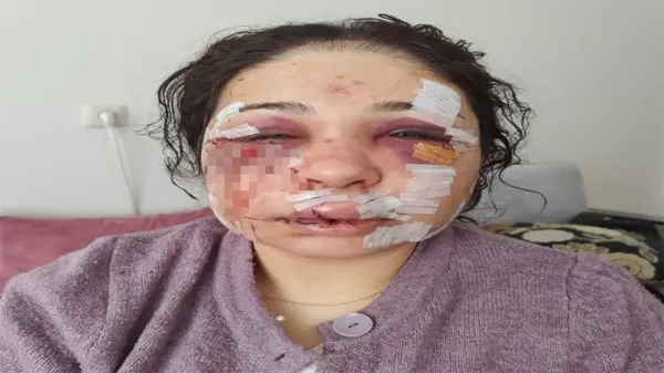 Polis memuru Yasin Çakmak'ın eşini darp davasında tahliye edilmesi