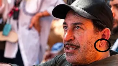 Cem Yılmaz'ın Kalp Krizi Sonrası Sağlık Durumu ve Kulak Memesindeki 'Frank İşareti' Tartışması