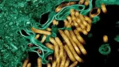 Demokratik Kongo Cumhuriyeti'nde Ebola Salgını: 65 Kişi Hayatını Kaybetti