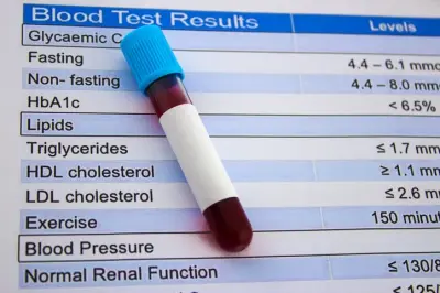 Kolesterol Tedavisinde Yeni Dönem: İlk Oral PCSK9 İnhibitörü FDA Onayı Aldı