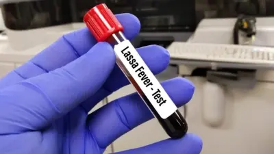 Nijerya'da Lassa Ateşi Kaynaklı Can Kaybı 190'a Yükseldi